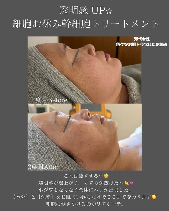 画像255