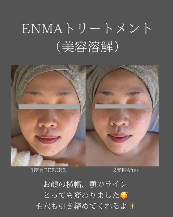 画像296