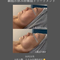 画像303