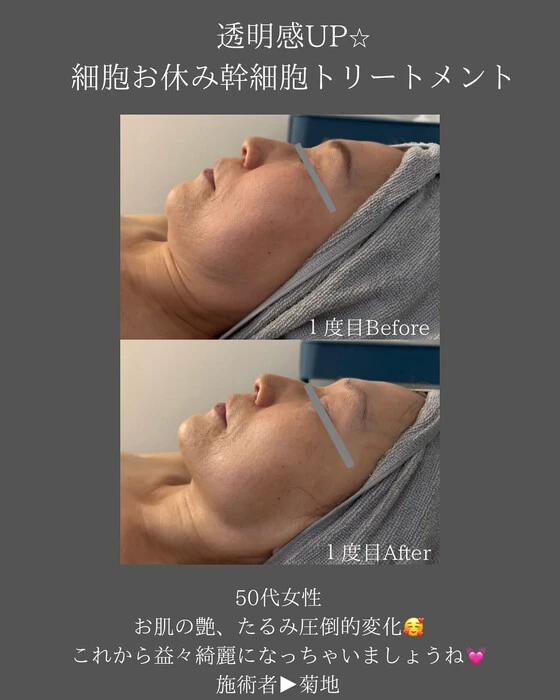 画像303