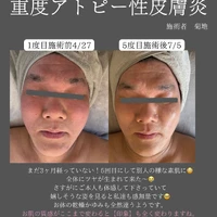 画像339