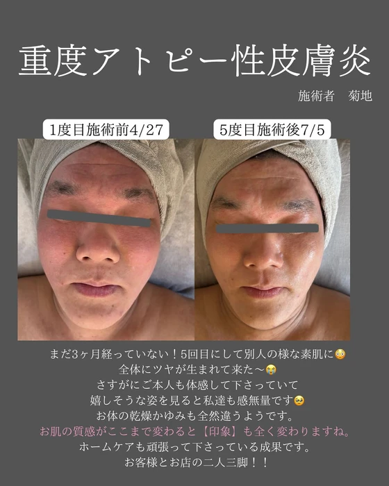 画像339