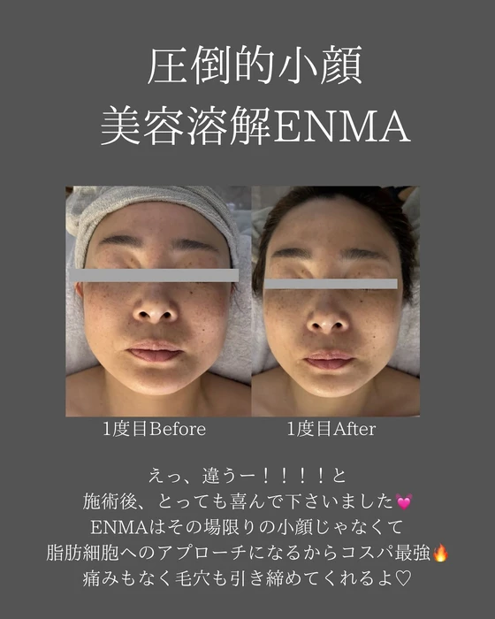 画像343