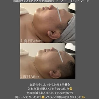 画像351