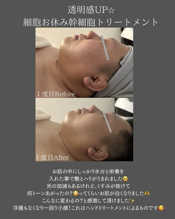 画像351