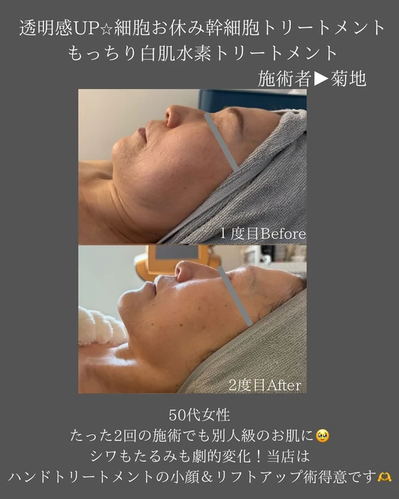 画像374