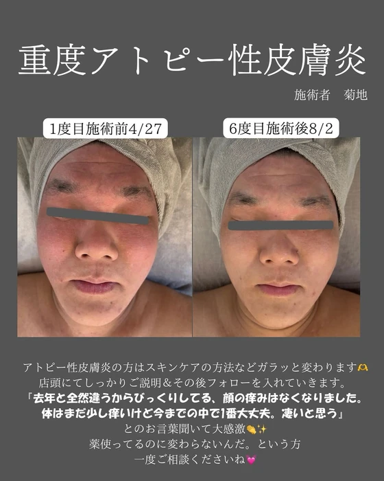 画像386