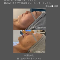 画像388