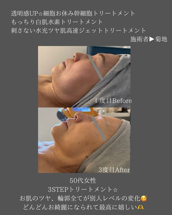画像388