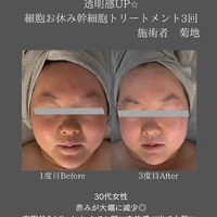 画像426