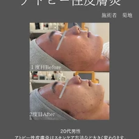 画像432