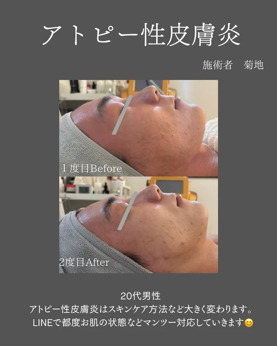 画像432