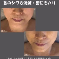 画像456