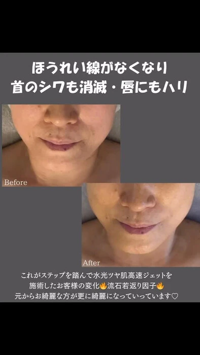 画像456