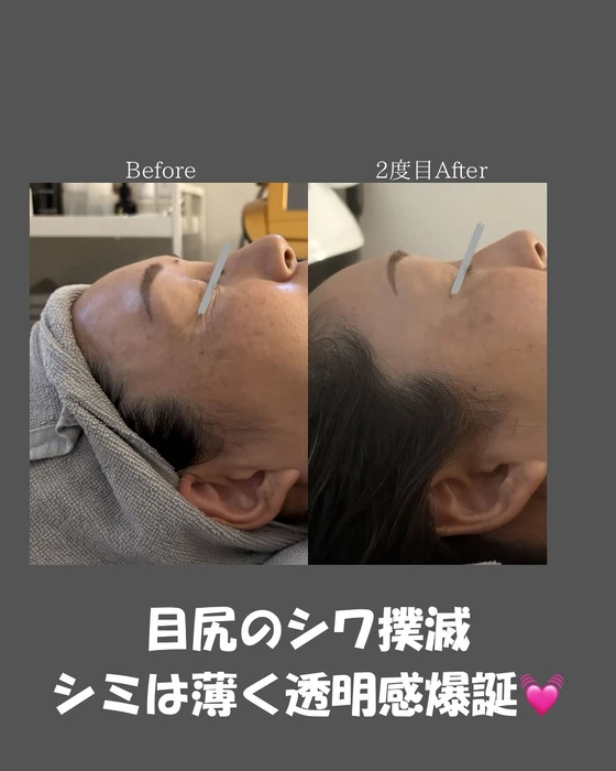 画像460