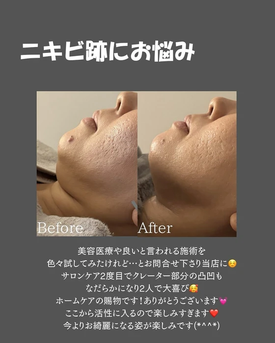 画像468