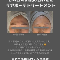 画像501