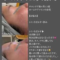 画像515