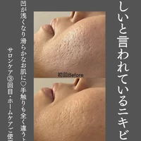画像517