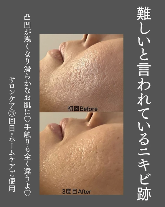 画像517