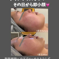画像530