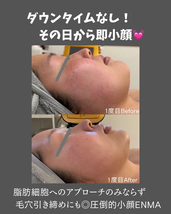 画像530
