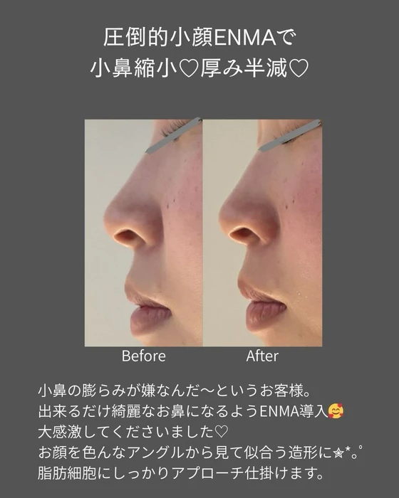 画像586
