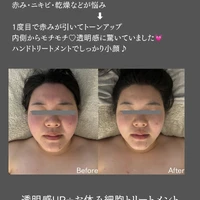 画像621