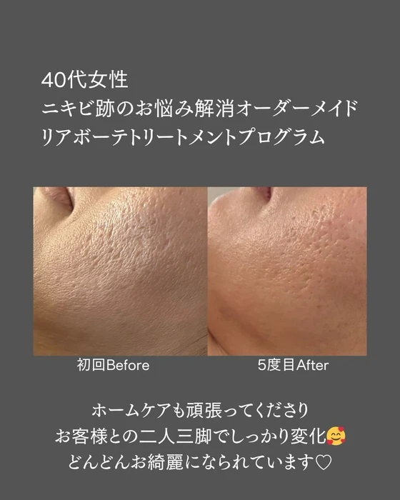 画像625