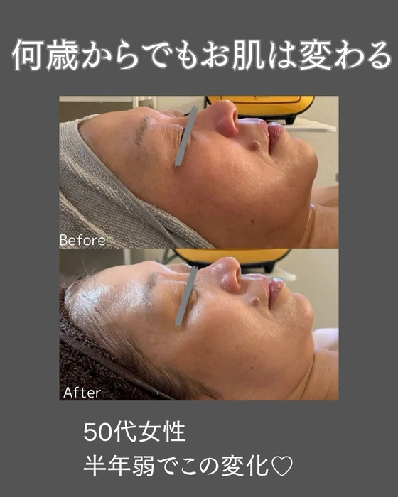 画像725