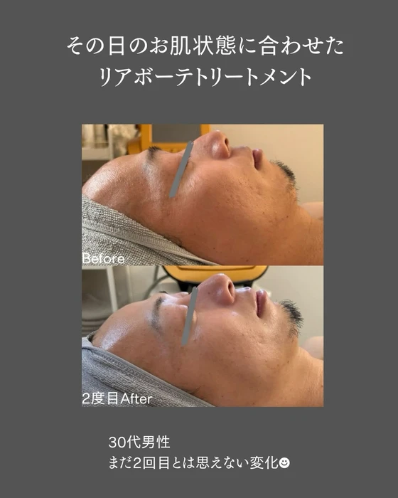 画像741
