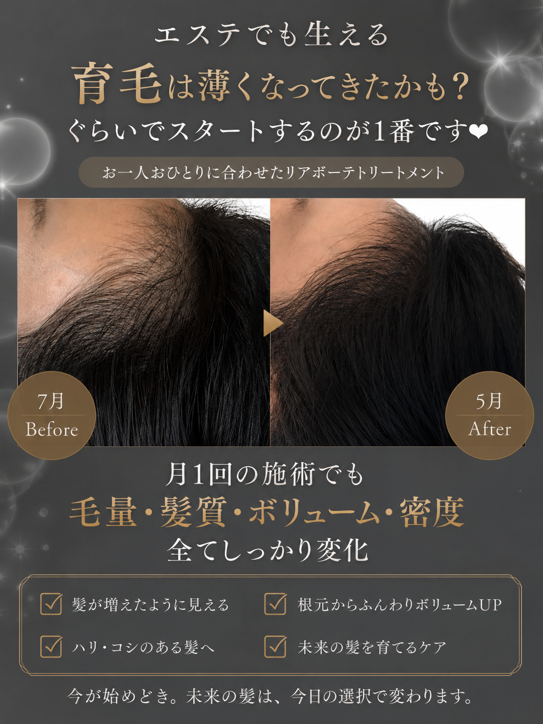 最新育毛技術で髪の再生をサポート