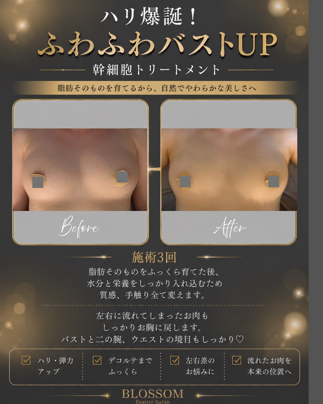 たるみ改善と持続的なケア