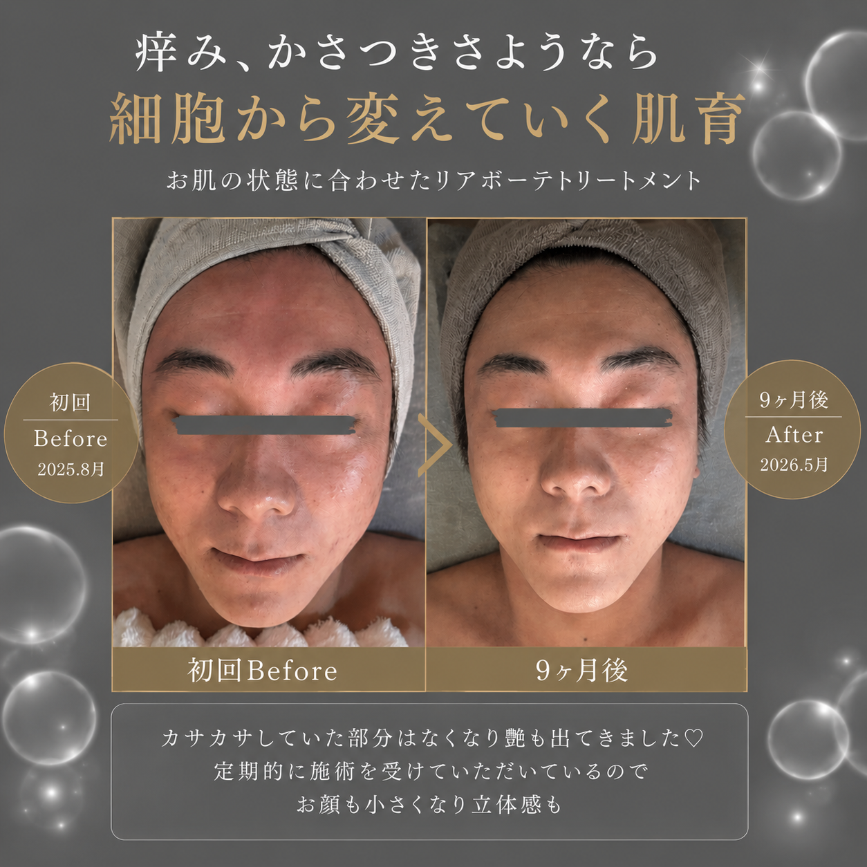 3. 自然なツヤ肌を実現する施術