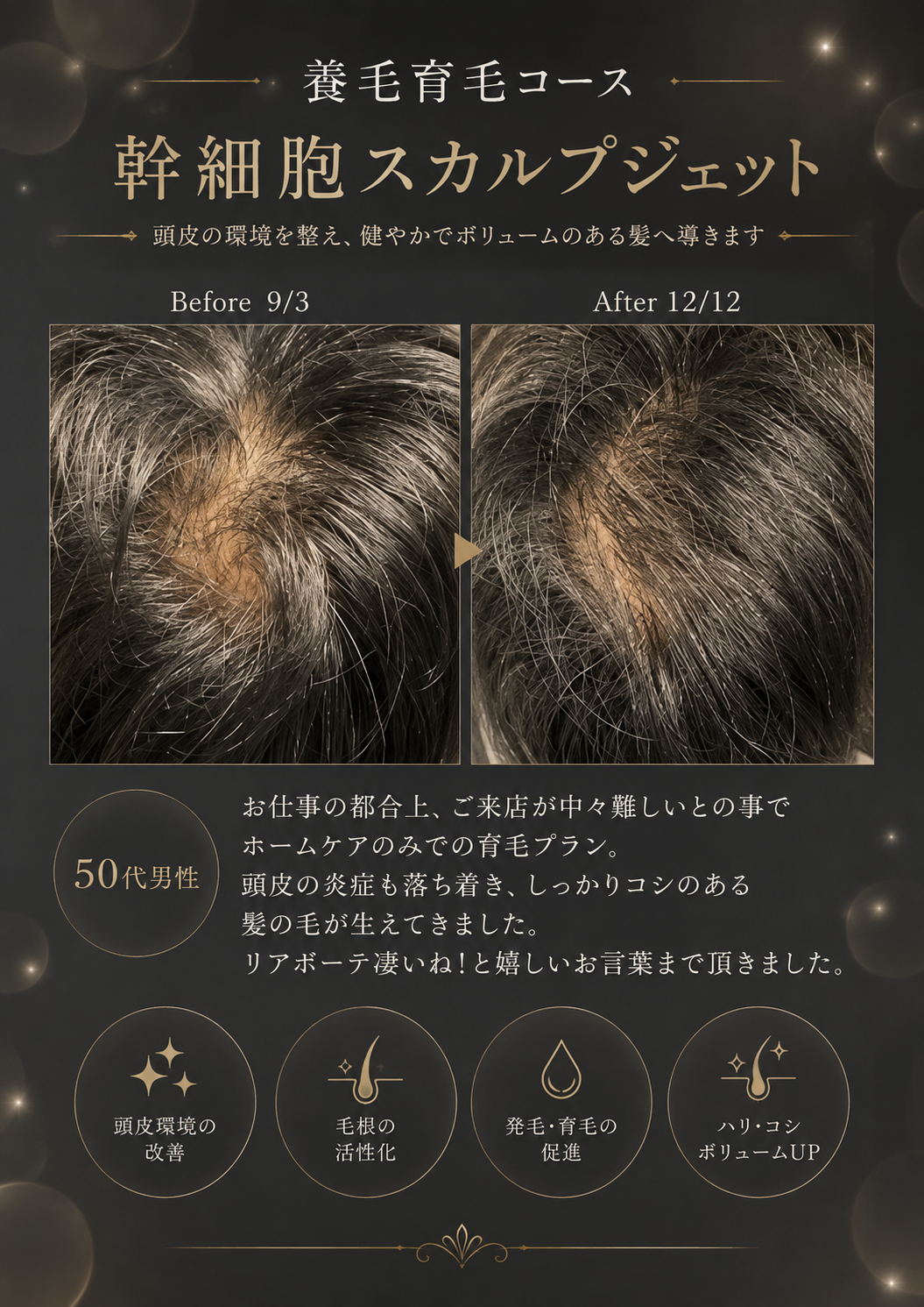 小顔コルギの魅力