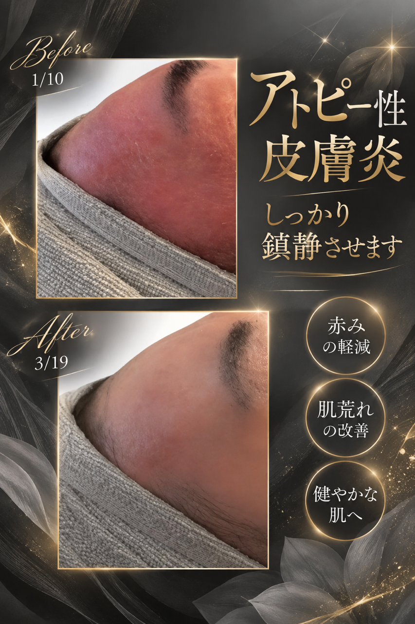 肌の再生を促す革新技術