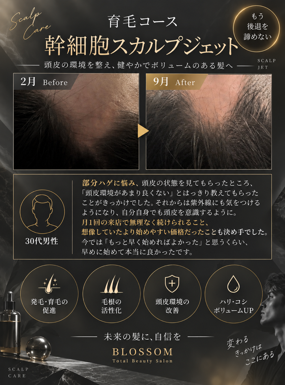 自然派アプローチで薄毛を乗り越え、宇都宮で髪のボリュームを取り戻そう！